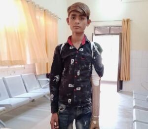 कृत्रिम हाथ पाकर बच्चों के खिले चेहरे - मुकेश गर्ग